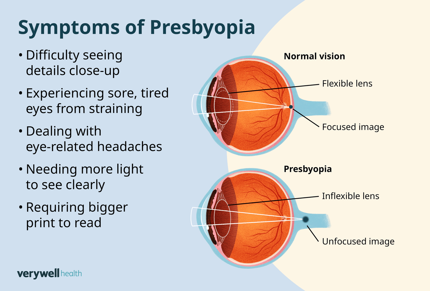 reading glasses and presbyopia